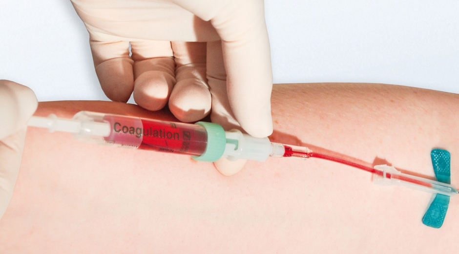 Handling Blood Samples - 5 Good Practices